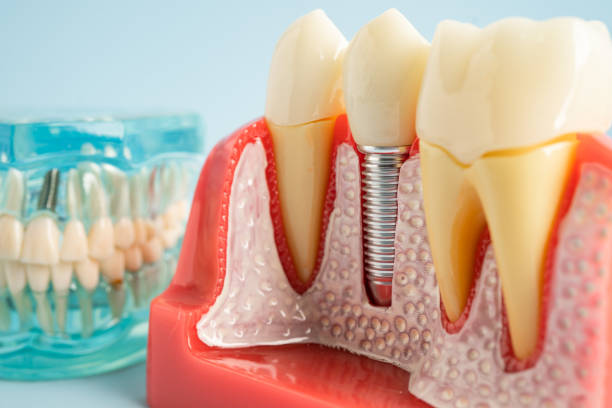 Professional Dental Services in Seneca, KS